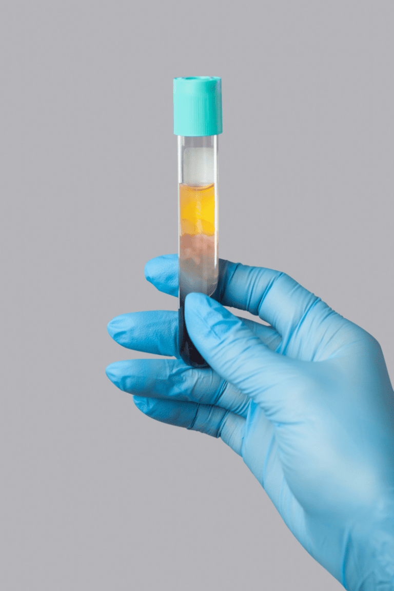 Blutentnahme und Zentrifugation zur Gewinnung von plättchenreichem Plasma (PRP) für ästhetische und regenerative Behandlungen.